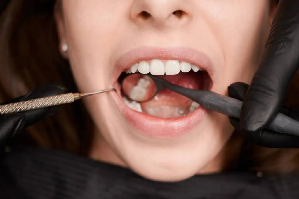Dentist examining a patient's teeth using dental tools and a mirror