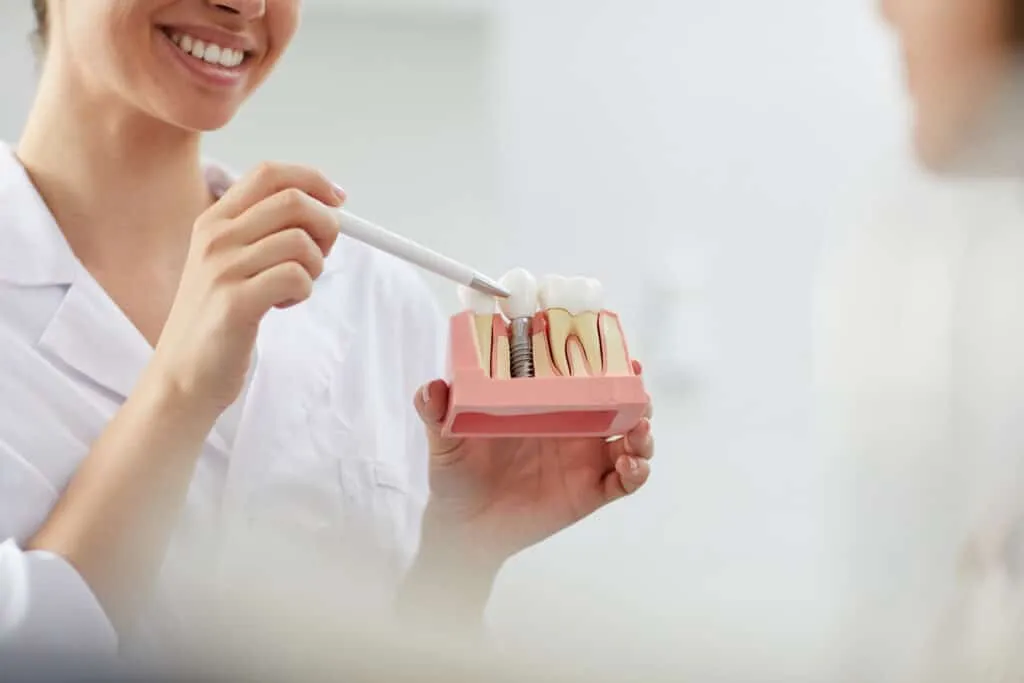Dentist explaining tooth implantation to a patient