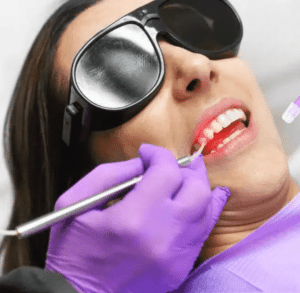 diagnodent laser dentist victoria Tx
