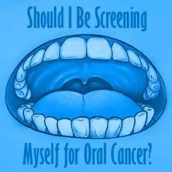 Should I Be Screening Myself for Oral Cancer? 5 A black and white image with the text "Should I Be Screening Myself for Oral Cancer?" written in a large font.