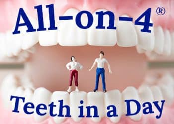 A man and a woman standing on top of a model of teeth. The text above the image says "All-on-4® Teeth in a Day."