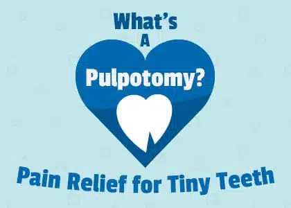 What’s a Pulpotomy? Pain Relief for Tiny Teeth 3 A blue heart with a white tooth in it. The text above the heart says "What's a Pulpotomy?" and the text below the heart says "Pain Relief for Tiny Teeth."