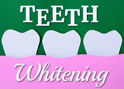 Types for All Stripes: Teeth Whitening 10 The image shows a row of teeth on a green background with the words "teeth whitening" written on it.