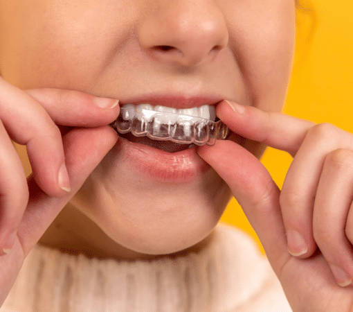 Young woman applying aligner.