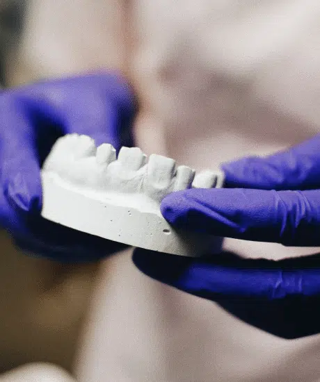 Dental Problems from Nail Biting 9 Restorative Dentistry