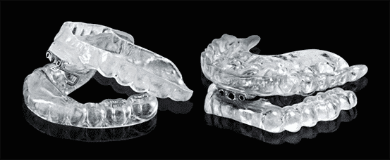 The image shows two clear aligners on a black background. The aligners are slightly curved and fit over the teeth.