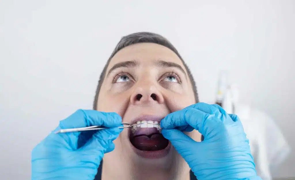 How to fix a cracked tooth. 17 Dentist performing oral examination with tools.