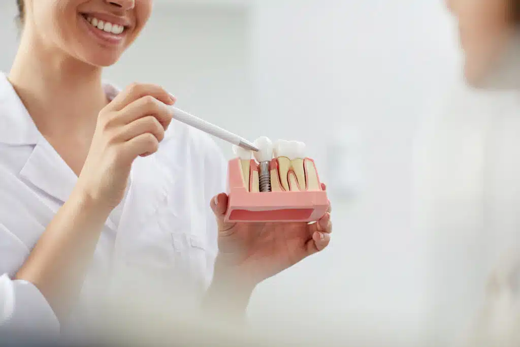 Dentist demonstrating a dental implant model with a pointer while smiling.