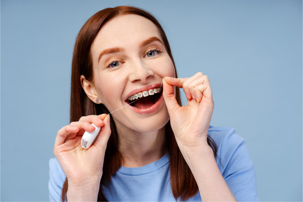 How To Floss With Braces