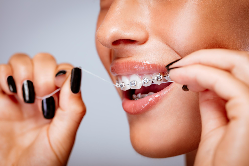 Lady flossing teeth with braces