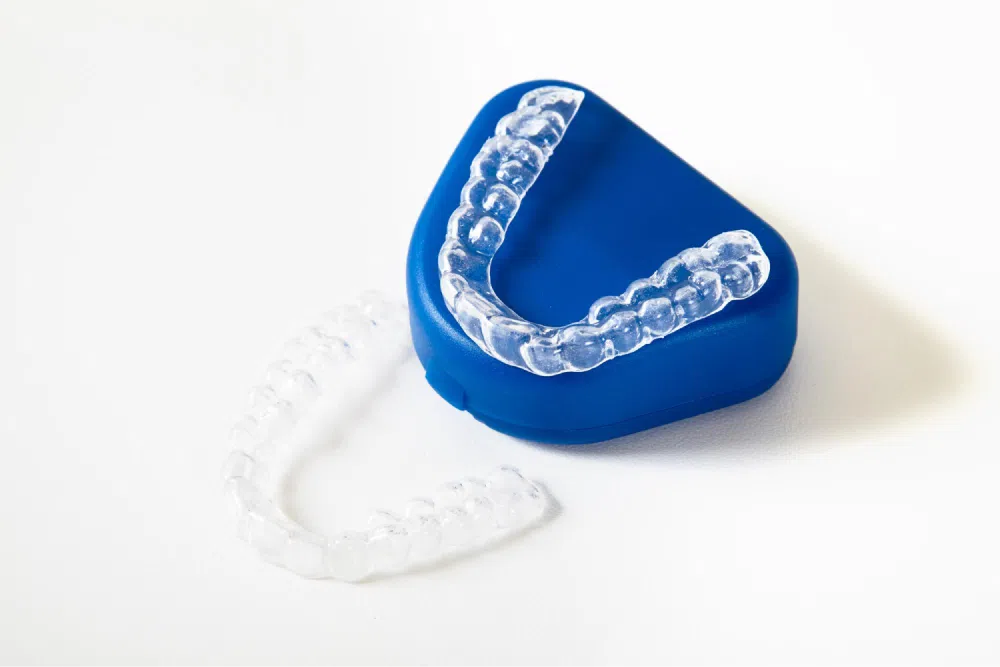 A Good Time for Your Child to Begin Braces 5 Clear aligners with blue case.