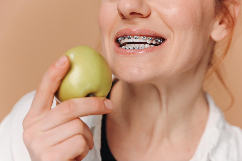 Woman with braces holding apple.