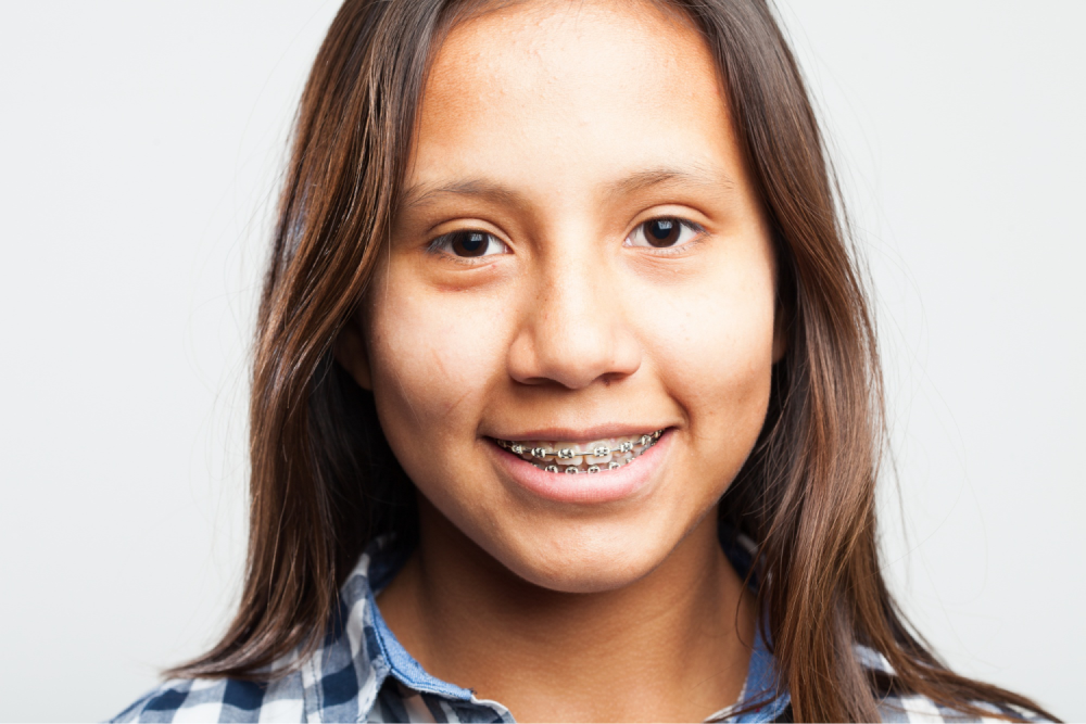 Girl smiling with dental braces.