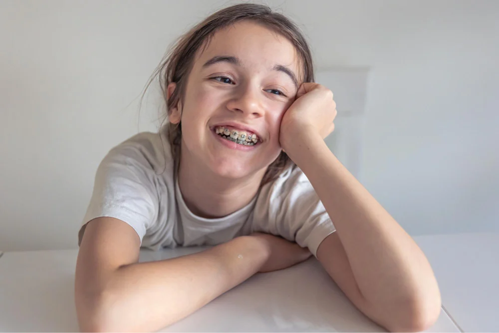 A Good Time for Your Child to Begin Braces 4 Child smiling with dental braces.
