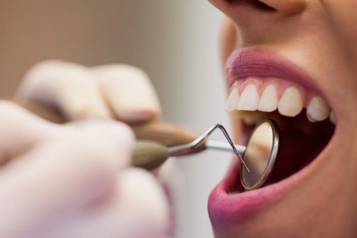 Close-up of dental checkup procedure.