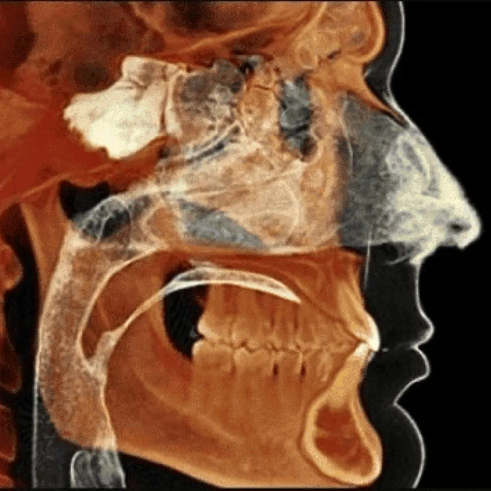 CFD Advanced tech photo XRay