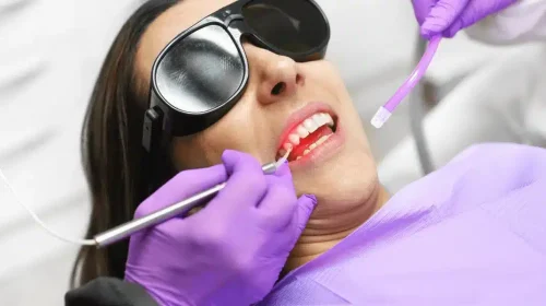 image of a woman receiving treatment of Low Light Laser Therapy In Dentistry at a dentist's hospital.